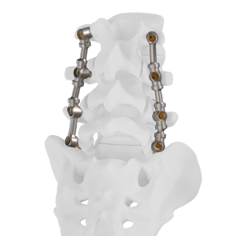 Medical Orthopedic Device Image