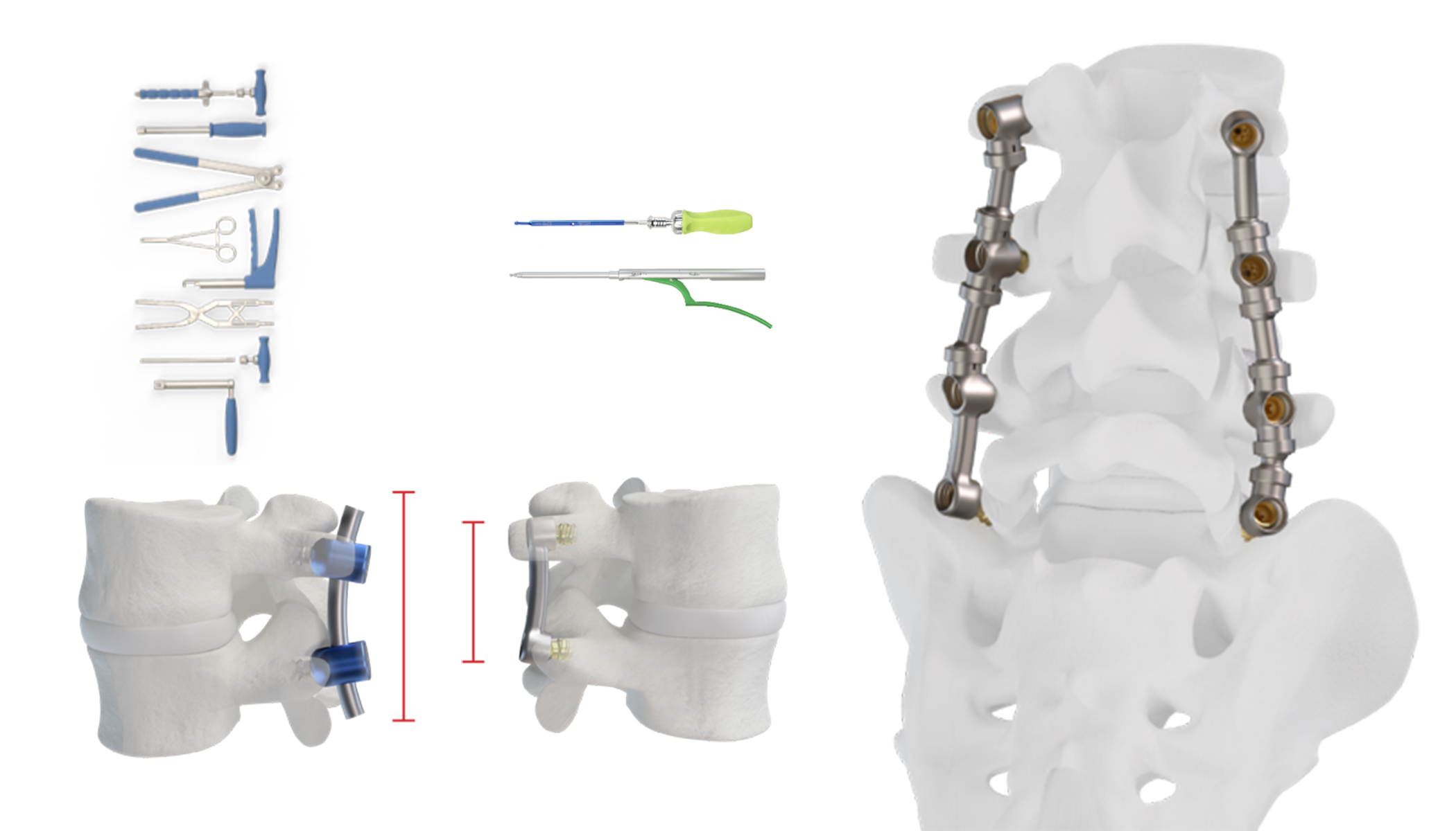 Orthopedic device suite